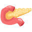 췌담도암